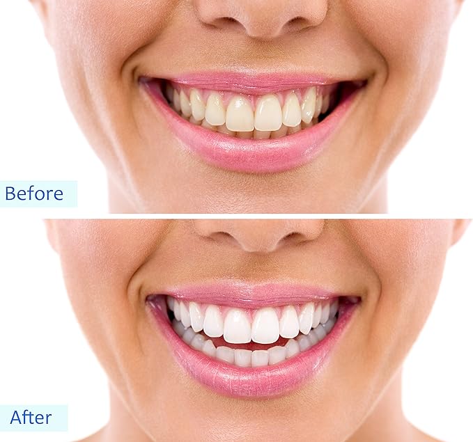 Activated Charcoal Teeth Whitening Powder - Dwellus