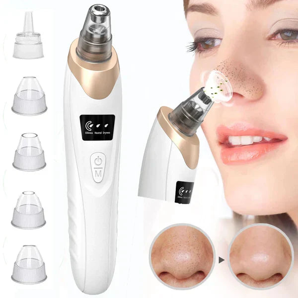 Electric Blackhead Remover - Dwellus