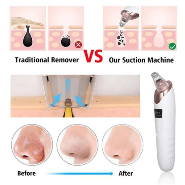 Electric Blackhead Remover - Dwellus