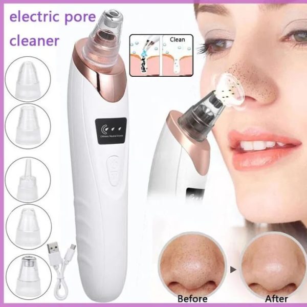 Electric Blackhead Remover - Dwellus